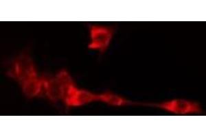 ABIN6275082 staining LOVO cells by IF/ICC. (DNAI2 抗体  (N-Term))