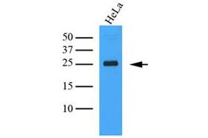 The Cell lysates (40ug) were resolved by SDS-PAGE, transferred to PVDF membrane and probed with anti-human MINCLE antibody (1:1000).