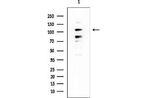 Western blot analysis of lysates from EC304 cells, using MCF2 Mouse Monoclonal Antibody at 1/1000 dilution.