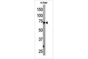 The ATG7 Antibody (Center) Pab (ABIN388521 and ABIN2849641) is used in Western blot to detect G7L in mouse liver tissue lysate. (ATG7 抗体  (AA 284-313))