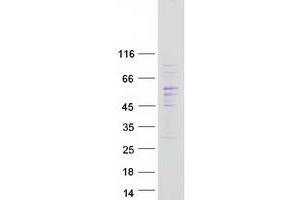 Western Blotting (WB) image for CDC42 Effector Protein (Rho GTPase Binding) 1 (CDC42EP1) (Transcript Variant 2) protein (Myc-DYKDDDDK Tag) (ABIN2718360)