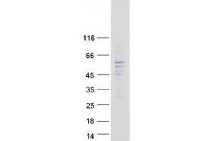 Validation with Western Blot (CDC42EP1 Protein (Transcript Variant 2) (Myc-DYKDDDDK Tag))