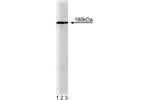 Western blot analysis of EEA1 on rat brain lysate. (EEA1 抗体  (AA 3-281))