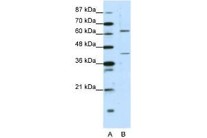 WB Suggested Anti-FOXP4 Antibody Titration:  1. (FOXP4 抗体  (C-Term))