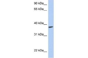 RTDR1 antibody used at 1 ug/ml to detect target protein. (RTDR1 抗体  (Middle Region))
