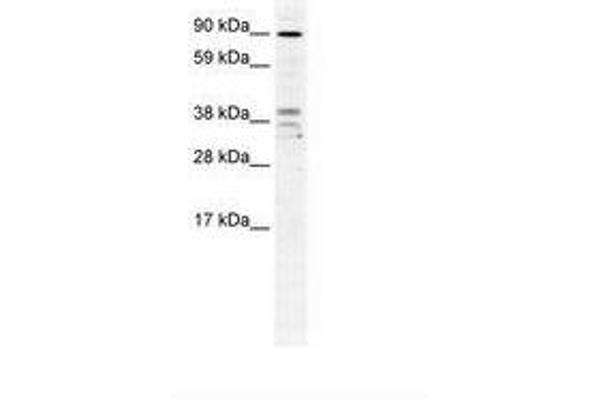 ZC3H7B 抗体  (AA 136-185)