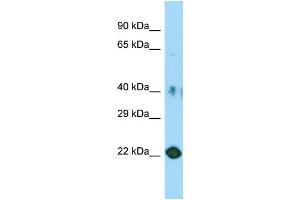Host: Rabbit Target Name: C11orf34 Sample Type: HT1080 Whole Cell lysates Antibody Dilution: 1. (Plet1 抗体  (Middle Region))