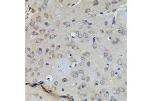 Immunohistochemistry of paraffin-embedded rat brain using AURKC antibody (ABIN5995404) (40x lens).