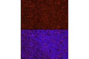 Immunofluorescence (IF) image for anti-Lymphoid Enhancer-Binding Factor 1 (LEF1) (AA 100-399) antibody (ABIN1680678)