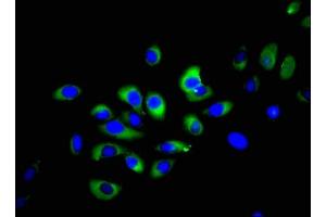 Immunofluorescent analysis of A549 cells using ABIN7161071 at dilution of 1:100 and Alexa Fluor 488-congugated AffiniPure Goat Anti-Rabbit IgG(H+L) (NCR1 抗体  (AA 121-230))