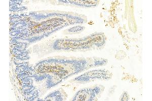 ABIN6256620 and ABIN6267337 at 1/100 staining Mouse colon tissue by IHC-P. (IGF1R 抗体  (pTyr1161))