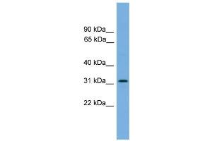 WB Suggested Anti-DAPP1  Antibody Titration: 0. (DAPP1 抗体  (Middle Region))