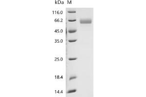 Erythropoietin (EPO) (AA 28-192), (full length) protein (hFc Tag)