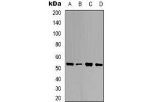Western blot analysis of Ubiquilin 4 expression in HEK293T (A), K562 (B), NIH3T3 (C), mouse brain (D) whole cell lysates. (UBQLN4 抗体)