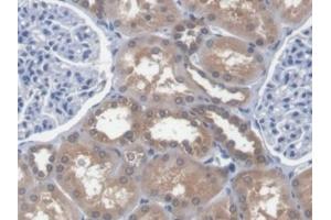 Detection of EEF1a1 in Human Kidney Tissue using Polyclonal Antibody to Eukaryotic Translation Elongation Factor 1 Alpha 1 (EEF1a1) (eEF1A1 抗体  (AA 1-241))