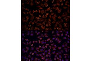 Immunofluorescence analysis of L929 cells using [KO Validated] KRAS Rabbit pAb (ABIN6132168, ABIN6143000, ABIN6143001 and ABIN6216439) at dilution of 100 (40x lens). (K-RAS 抗体  (AA 30-188))
