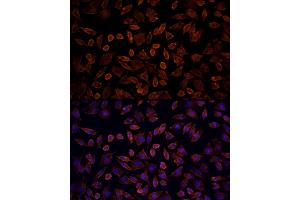 Immunofluorescence analysis of L929 cells using [KO Validated] KRAS Rabbit pAb (ABIN6132168, ABIN6143000, ABIN6143001 and ABIN6216439) at dilution of 100 (40x lens). (K-RAS 抗体  (AA 30-188))