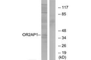 Western blot analysis of extracts from Jurkat cells, using OR2AP1 Antibody. (OR2AP1 抗体  (AA 231-280))