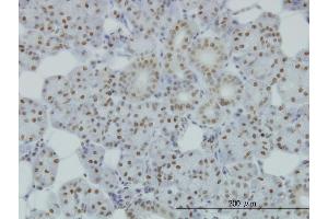 Immunoperoxidase of monoclonal antibody to SMC1L1 on formalin-fixed paraffin-embedded human salivary gland. (SMC1A 抗体  (AA 366-465))