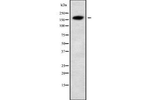 Western blot analysis of ALS2 using MCF7 whole cell lysates (ALS2 抗体  (N-Term))
