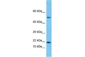 Western Blotting (WB) image for anti-Growth Arrest and DNA-Damage-Inducible, beta (GADD45B) (Middle Region) antibody (ABIN2783334)