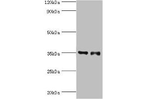 Western blot All lanes: Estrogen sulfotransferase antibody at 7 μg/mL Lane 1: Mouse lung tissue Lane 2: Mouse liver tissue Secondary Goat polyclonal to rabbit IgG at 1/10000 dilution Predicted band size: 35, 30 kDa Observed band size: 35 kDa (SULT1E1 抗体  (AA 140-294))
