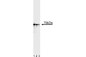 Western Blotting (WB) image for anti-Tumor Protein P73 (TP73) (AA 380-367) antibody (ABIN967629) (Tumor Protein p73 抗体  (AA 380-367))