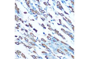 Immunohistochemistry of paraffin-embedded mouse stomach using DMT1 Rabbit pAb (ABIN6129471, ABIN6147839, ABIN6147840 and ABIN6214400) at dilution of 1:100 (40x lens). (SLC11A2 抗体  (AA 1-100))