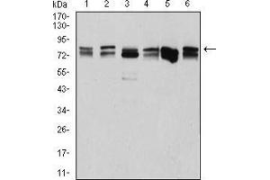Western Blotting (WB) image for anti-DEAD (Asp-Glu-Ala-Asp) Box Polypeptide 3, X-Linked (DDX3X) (AA 518-661) antibody (ABIN5542508)