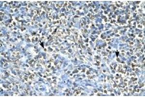 Immunohistochemical staining (Formalin-fixed paraffin-embedded sections) of human spleen with ASGR2 polyclonal antibody  at 4-8 ug/mL working concentration. (Asialoglycoprotein Receptor 2 抗体  (N-Term))