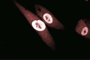 Immunofluorescence staining of human fibroblasts. (GSTP1 抗体  (AA 5-210))