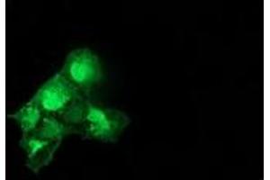 Anti-CAT mouse monoclonal antibody (ABIN2454330) immunofluorescent staining of COS7 cells transiently transfected by pCMV6-ENTRY CAT (RC210763). (Catalase 抗体)