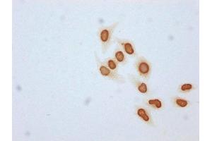 Immunocytochemistry analysis of ABIN7139176 diluted at 1:25 and staining in Hela cells (treated with 30mM sodium butyrate for 4h) performed on a Leica BondTM system. (HIST1H4A 抗体  (acLys31))