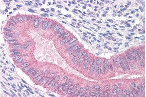 Immunohistochemistry (IHC) image for anti-Catenin (Cadherin-Associated Protein), alpha 1, 102kDa (CTNNA1) (Internal Region) antibody (ABIN185626)