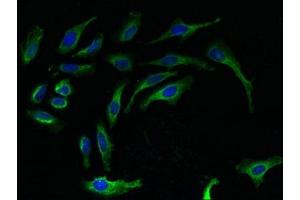 Immunofluorescent analysis of Hela cells using ABIN7142788 at dilution of 1:100 and Alexa Fluor 488-congugated AffiniPure Goat Anti-Rabbit IgG(H+L) (RPL27 抗体  (AA 2-136))