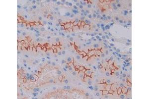 Used in DAB staining on fromalin fixed paraffin- embedded kidney tissue (CAMK1 抗体  (AA 1-370))