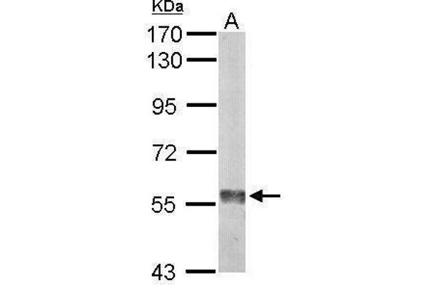Monoamine Oxidase B 抗体