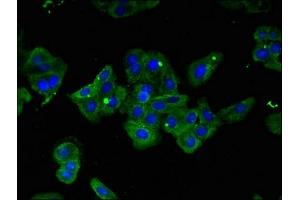 Immunofluorescent analysis of HepG2 cells using ABIN7156627 at dilution of 1:100 and Alexa Fluor 488-congugated AffiniPure Goat Anti-Rabbit IgG(H+L) (IRF6 抗体  (AA 43-285))