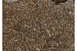 ABIN6273072 at 1/100 staining Mouse spleen tissue by IHC-P. (SECISBP2 抗体  (Internal Region))