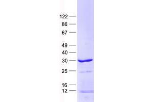 Validation with Western Blot (PITX2 Protein (His tag))