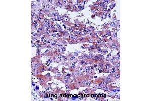 Immunohistochemistry (IHC) image for anti-Complement Decay-Accelerating Factor (CD55) antibody (ABIN2998248) (CD55 抗体)