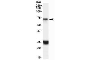 Western blot testing of human hippocampus lysate with HAP1 antibody at 0. (HAP1 抗体)