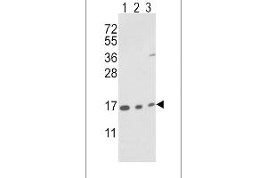 Western blot analysis of IA Antibody (N-term) (ABIN389487 and ABIN2839546) in T47D cell line(lane 1) and mouse brain(lane 2),bladder(lane 3) tissue lysates (35 μg/lane). (PPIA 抗体  (N-Term))