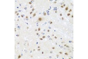 Immunohistochemistry (Paraffin-embedded Sections) (IHC (p)) image for anti-Centrin, EF-Hand Protein, 3 (CETN3) (AA 1-167) antibody (ABIN6138444)