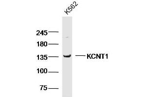 K562 cell lysates probed with KCNT1 Polyclonal Antibody, unconjugated  at 1:300 overnight at 4°C followed by a conjugated secondary antibody for 60 minutes at 37°C. (KCNT1 抗体  (AA 101-200))