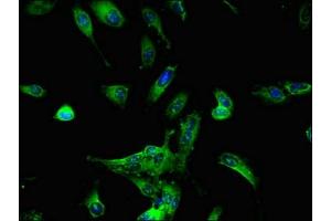 Immunofluorescent analysis of Hela cells using ABIN7164372 at dilution of 1:100 and Alexa Fluor 488-congugated AffiniPure Goat Anti-Rabbit IgG(H+L) (DDX6 抗体  (AA 1-149))