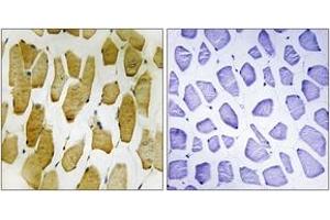 Immunohistochemistry analysis of paraffin-embedded human skeletal muscle, using Arachidonate 5 Lipoxygenase (Phospho-Ser271) Antibody. (ALOX5 抗体  (pSer272))