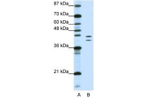 HNRPD antibody used at 1. (HNRNPD/AUF1 抗体)