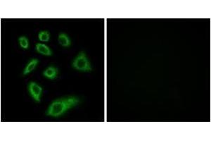 Immunofluorescence (IF) image for anti-Cytochrome P450, Family 2, Subfamily W, Polypeptide 1 (CYP2W1) (AA 311-360) antibody (ABIN1534393)