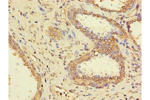 Immunohistochemistry (IHC) image for anti-Protein Phosphatase 1, Catalytic Subunit, gamma Isoform (PPP1CC) (AA 151-323), (Catalytic Subunit) antibody (ABIN7169312)